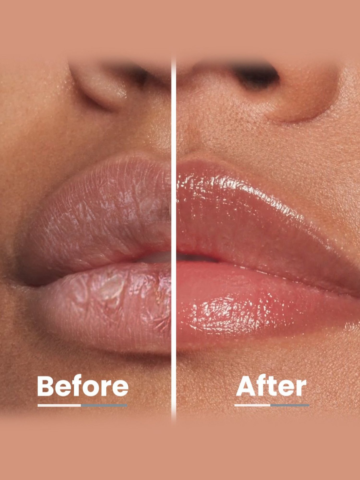 Hyphen All I Need Lipscreen SPF 30 - 10 gm