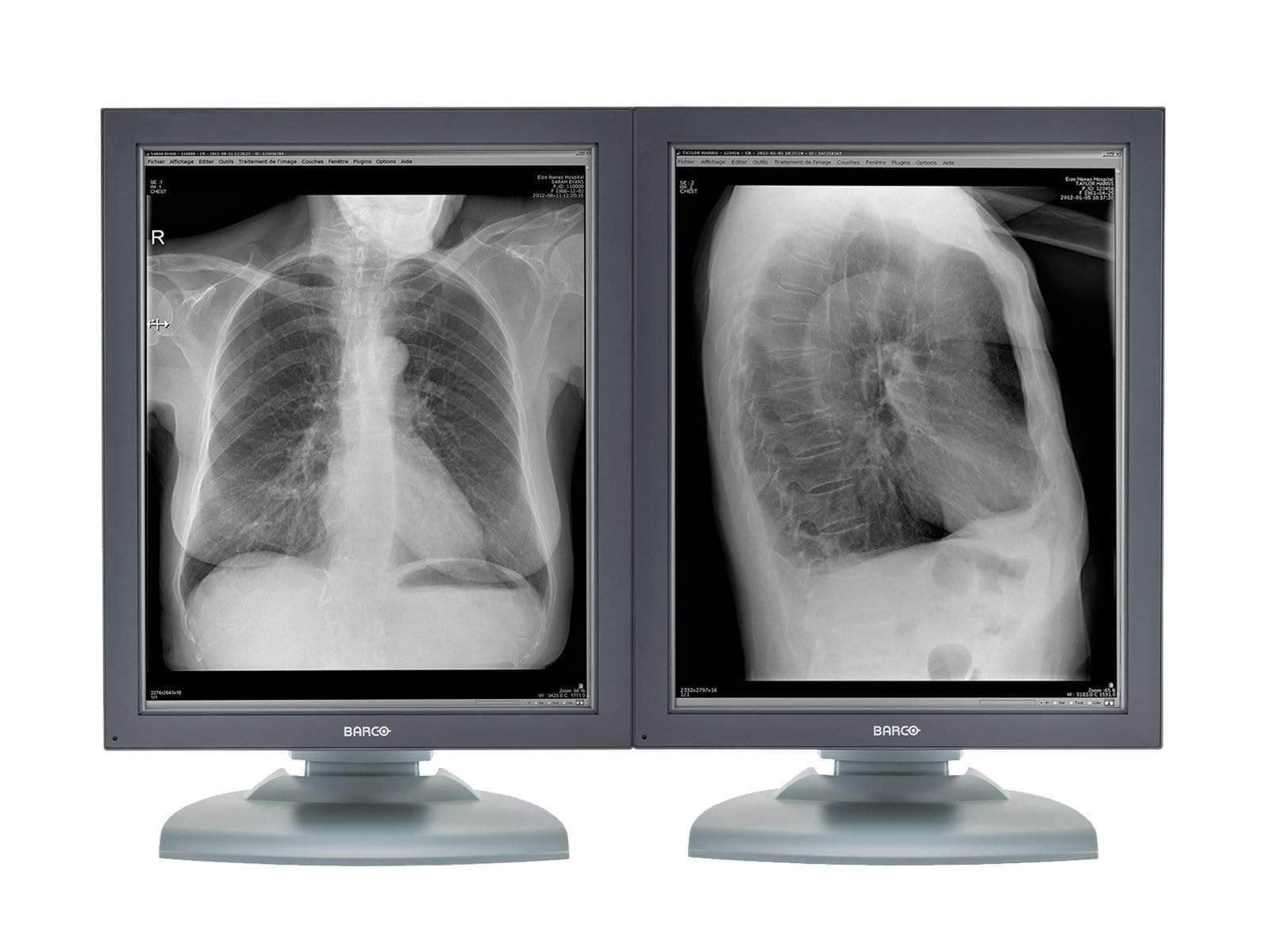 Pair (x2) Barco Nio MDNG-2121 2MP 21'' Grayscale Medical Diagnostic Radiology Monitor (K9601651)