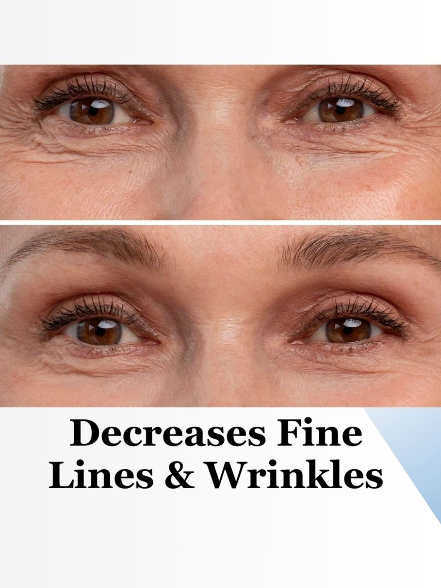 Vigini Under Eye Bye Bye Dark Circle Cream - 20 gm