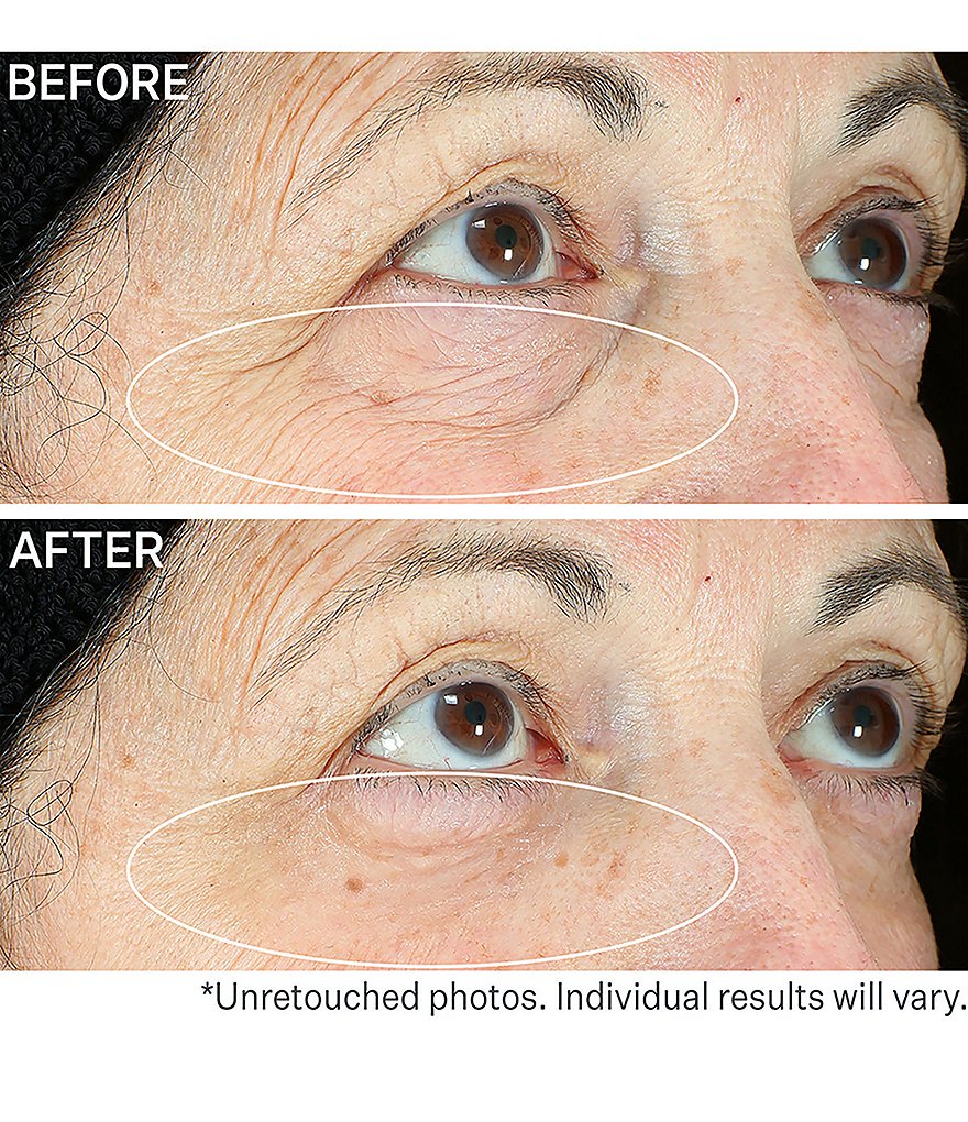 StriVectin Hyperlift Eye&trade; Instant Eye Fix Tightening Treatment