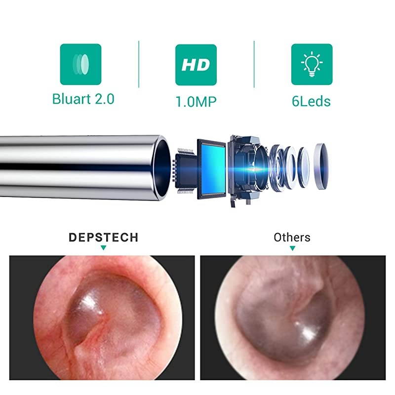 Otoscope Ear Endoscope  Digital 43mm HD Ear Scope with Earwax Removal WiFiUSB Ear Inspection Camera with 6 Adjustable LED Lights for iOS Android Mac Windows656Ft