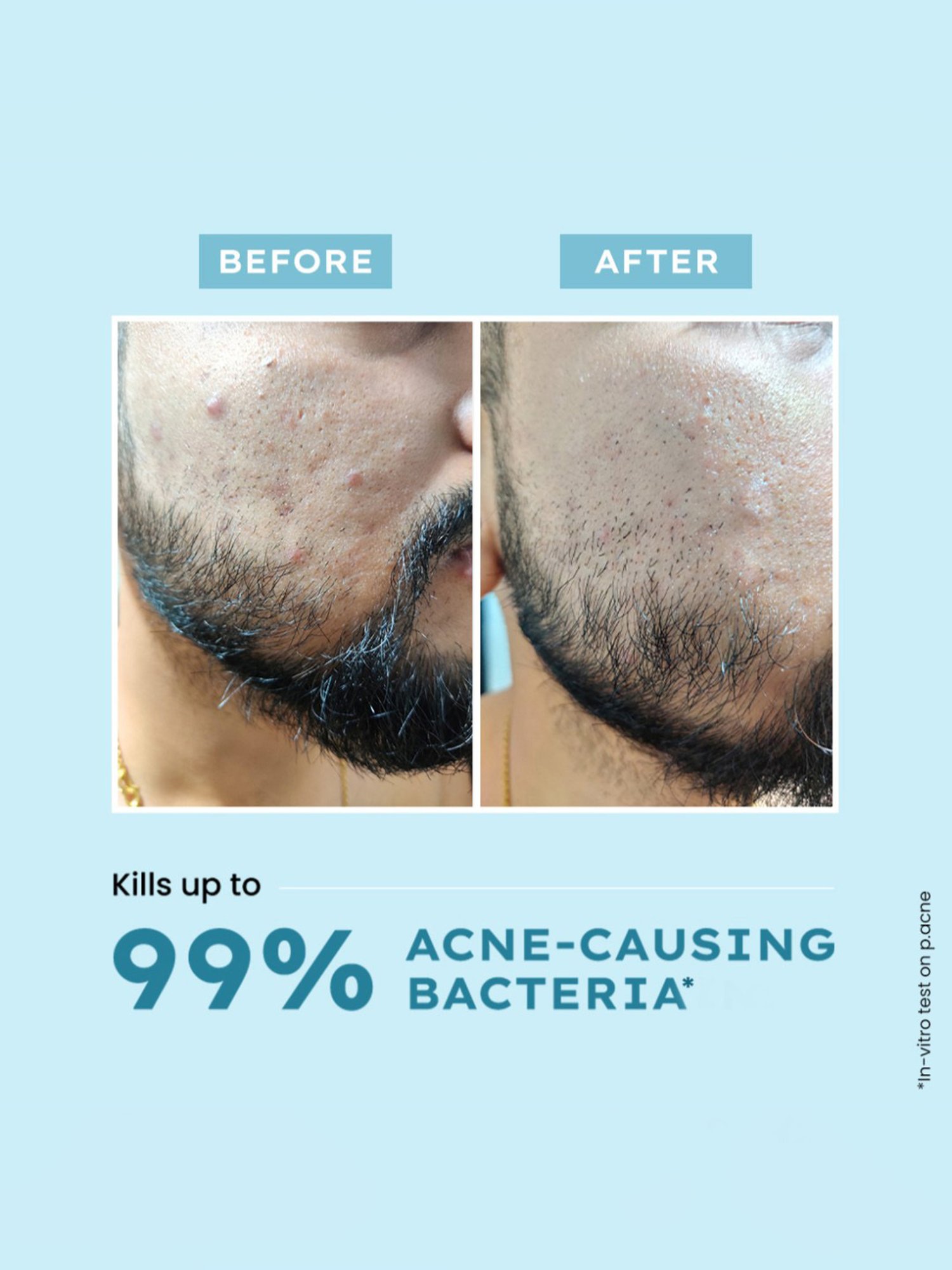 Lotus Herbals Illuminating Radiance Cleansing Foam - 100 gm