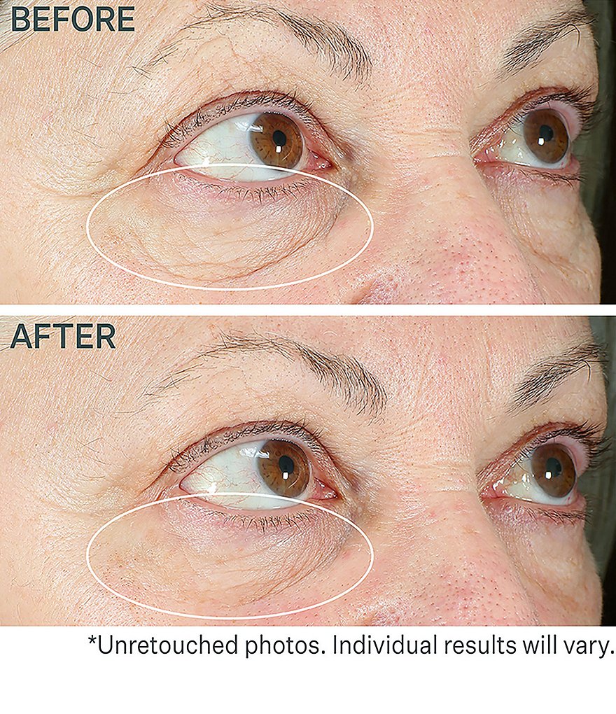 StriVectin Hyperlift Eye&trade; Instant Eye Fix Tightening Treatment