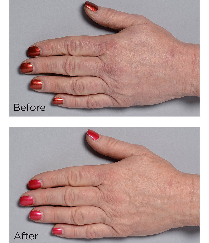 Perricone MD Cold Plasma Plus Hand Therapy