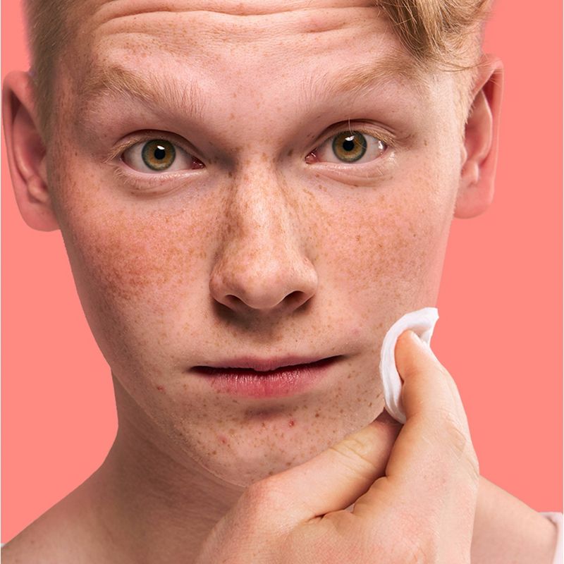 Clean & Clear Essentials Oil-Free Deep Cleaning Astringent - 8 fl oz