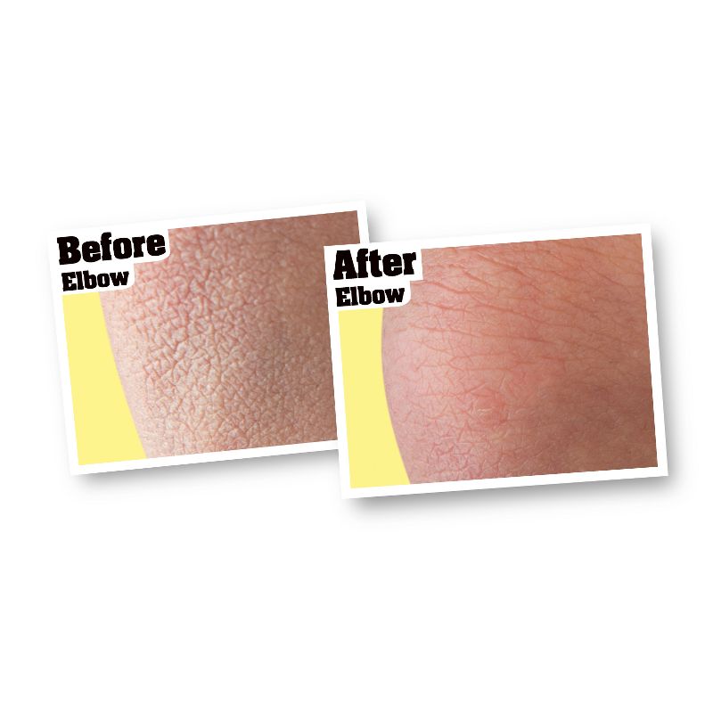 O'Keeffe's Skin Repair Body Lotion - 12oz