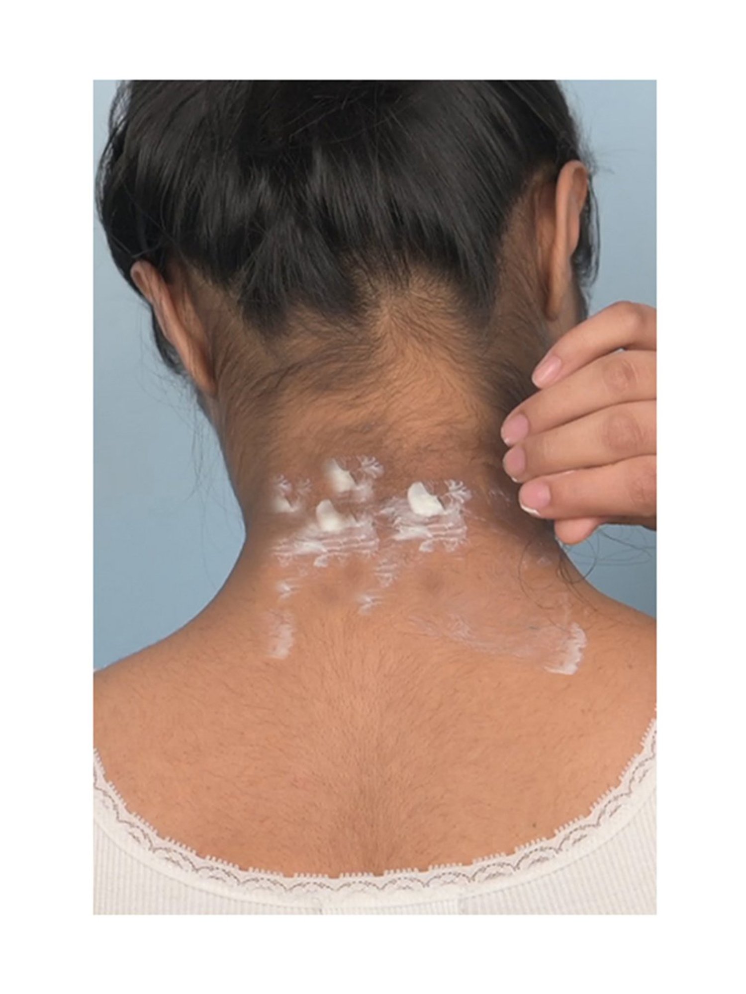 Sanfe Spotlite Lactic Acid and Retinol Body Cream - 60 gm