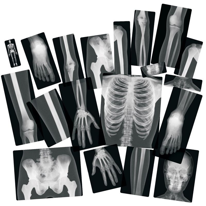 Royclo Human X-Rays on Film