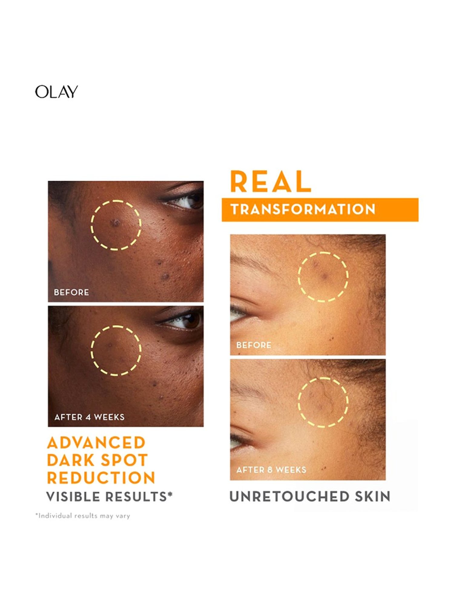 Olay The Vitamin C Kit