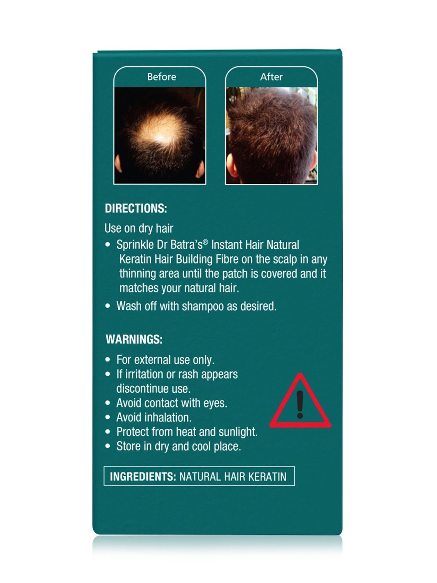 Dr. Batra's Instant Hair Natural Keratin Hair Building Fibre Dark Brown - 12 gm Each (Pack of 2)