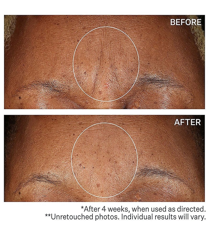 StriVectin SD Advanced&trade; PLUS Intensive Moisturizing Concentrate, 4 oz.