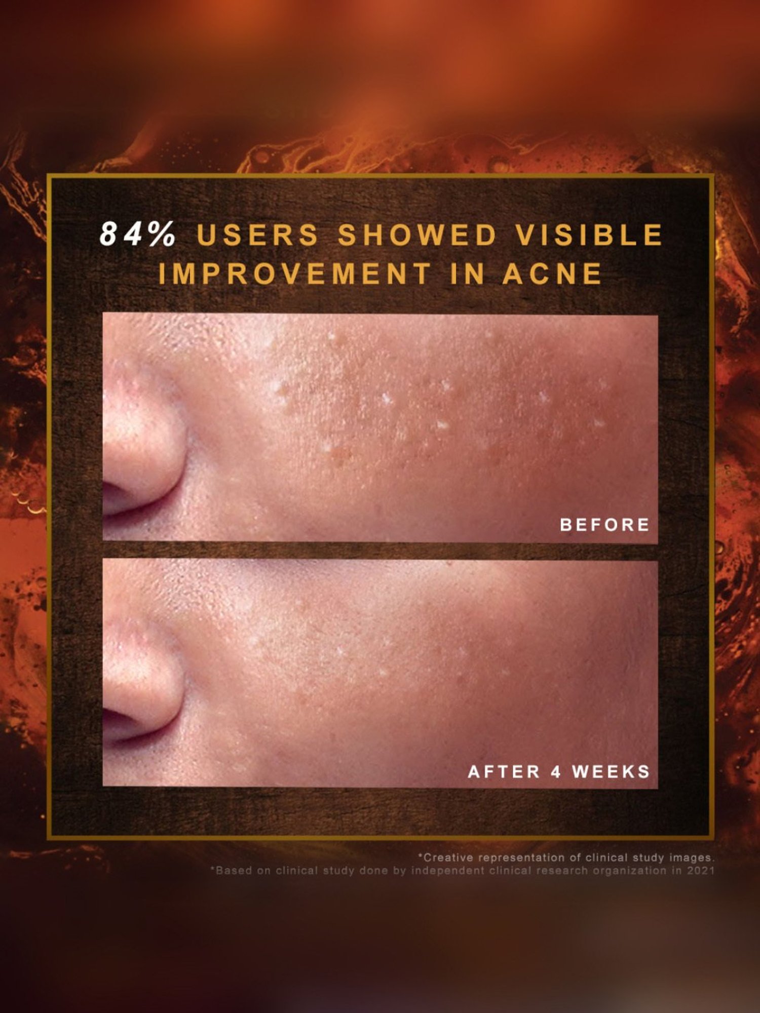 Indulekha Ayurvedic Proprietary Medicinal Soap - Pack of 3