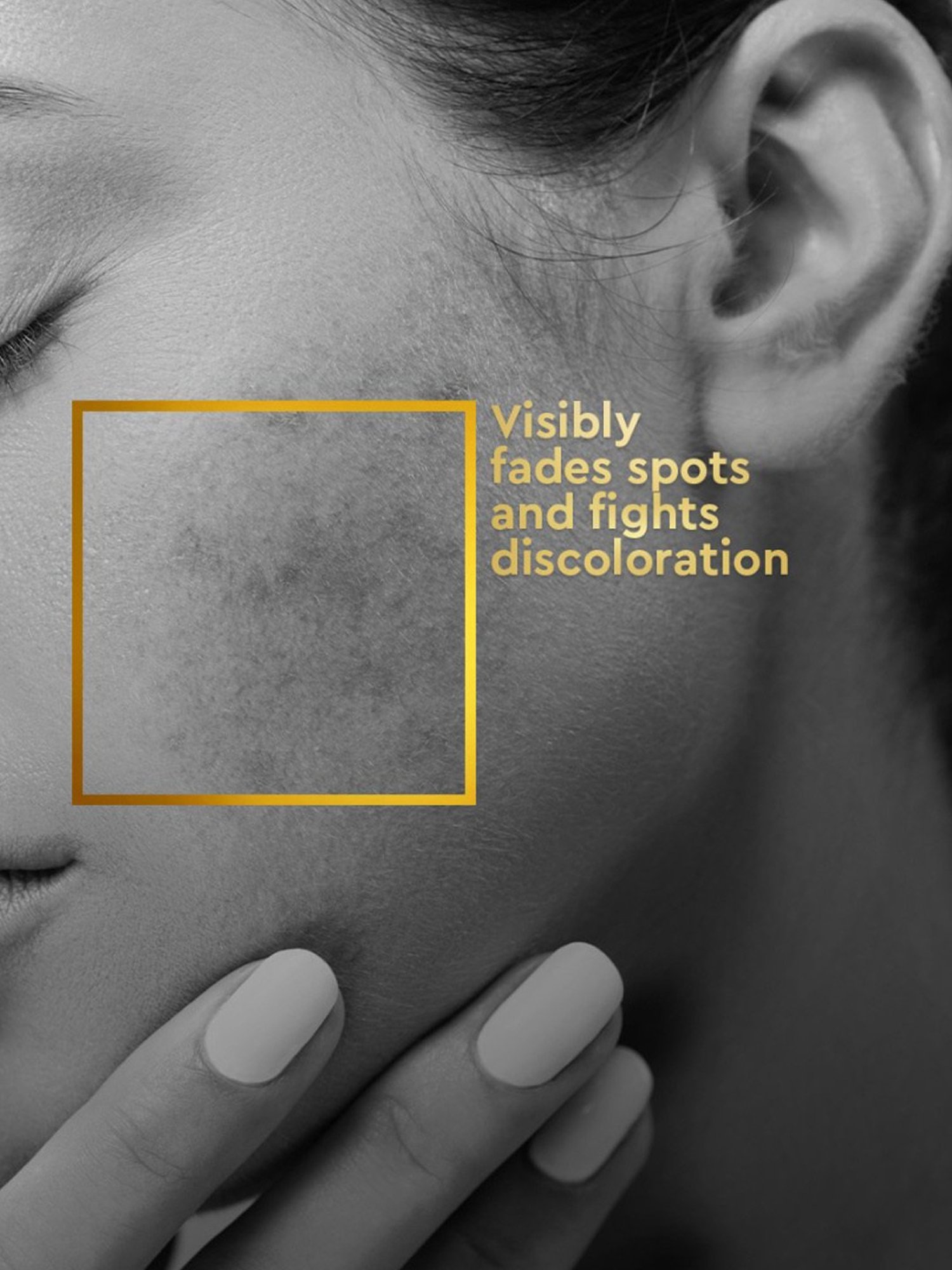 VLCC Clinic Spot Clarifying Face Wash - 150 ml