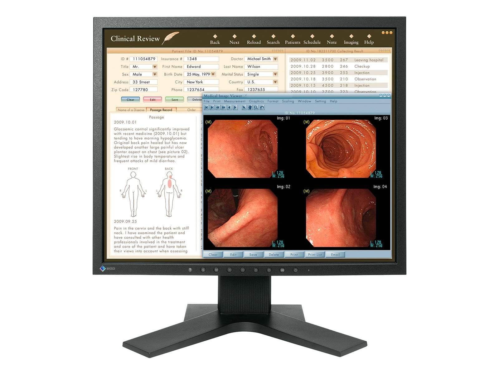 Eizo Radiforce MX194 1MP 19'' Clinical Review Monitor (MX194)