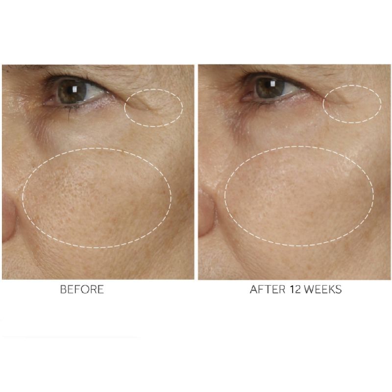 No7 Advanced Retinol 1.5% Complex Night Concentrate - 1 fl oz