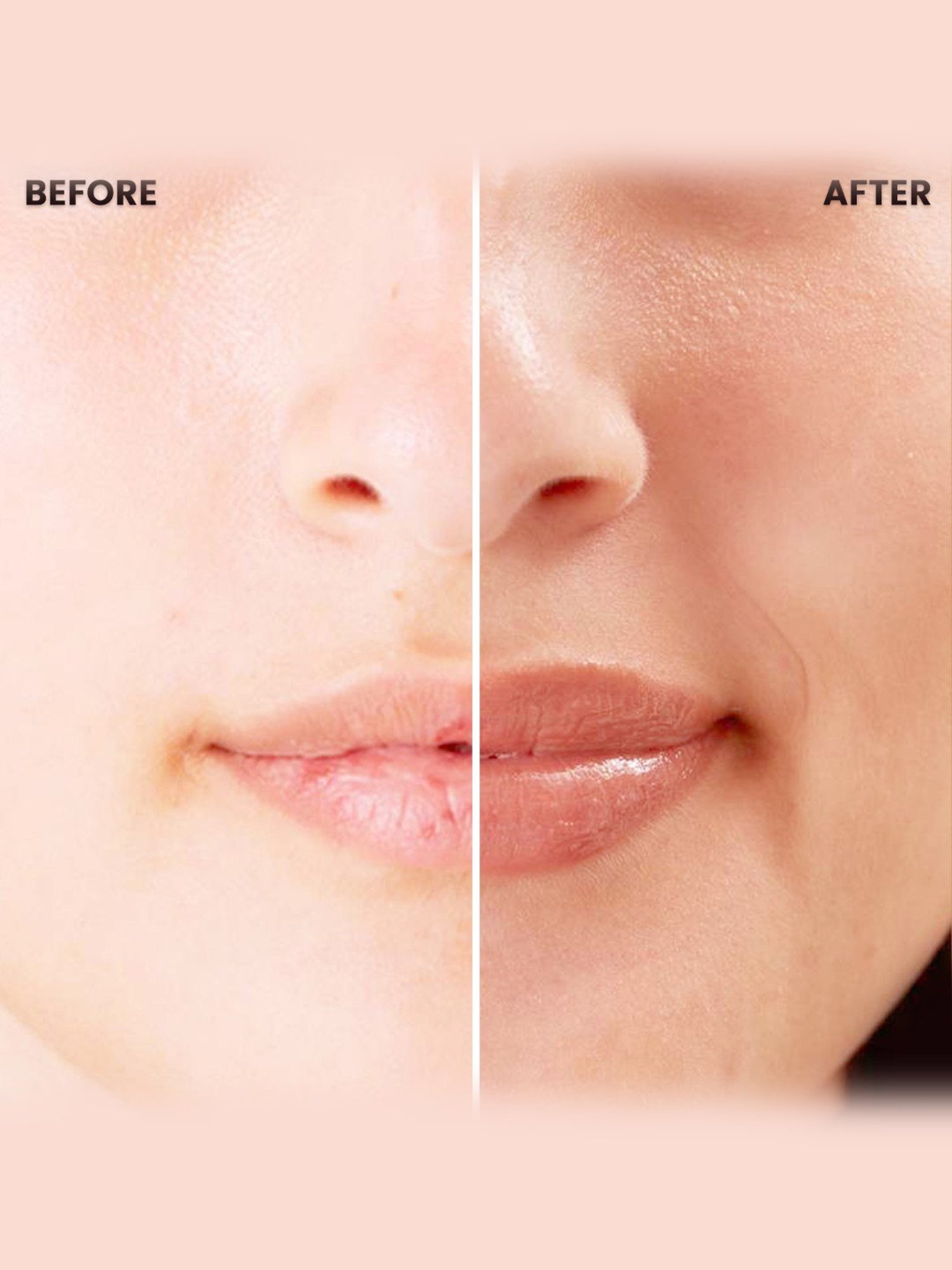 The Skin Story Almond Oil Nourishing Lip Balm SPF 15 for Chapped & Dark Lips - 25 gm