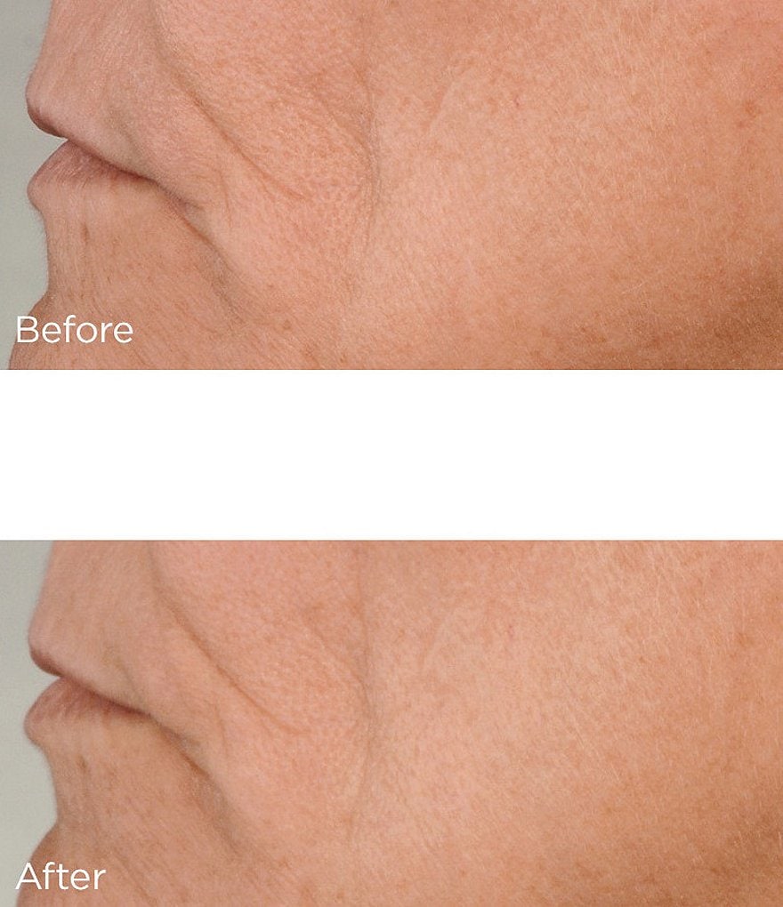 Perricone MD High Potency Classics Growth Factor Firming & Lifting Serum