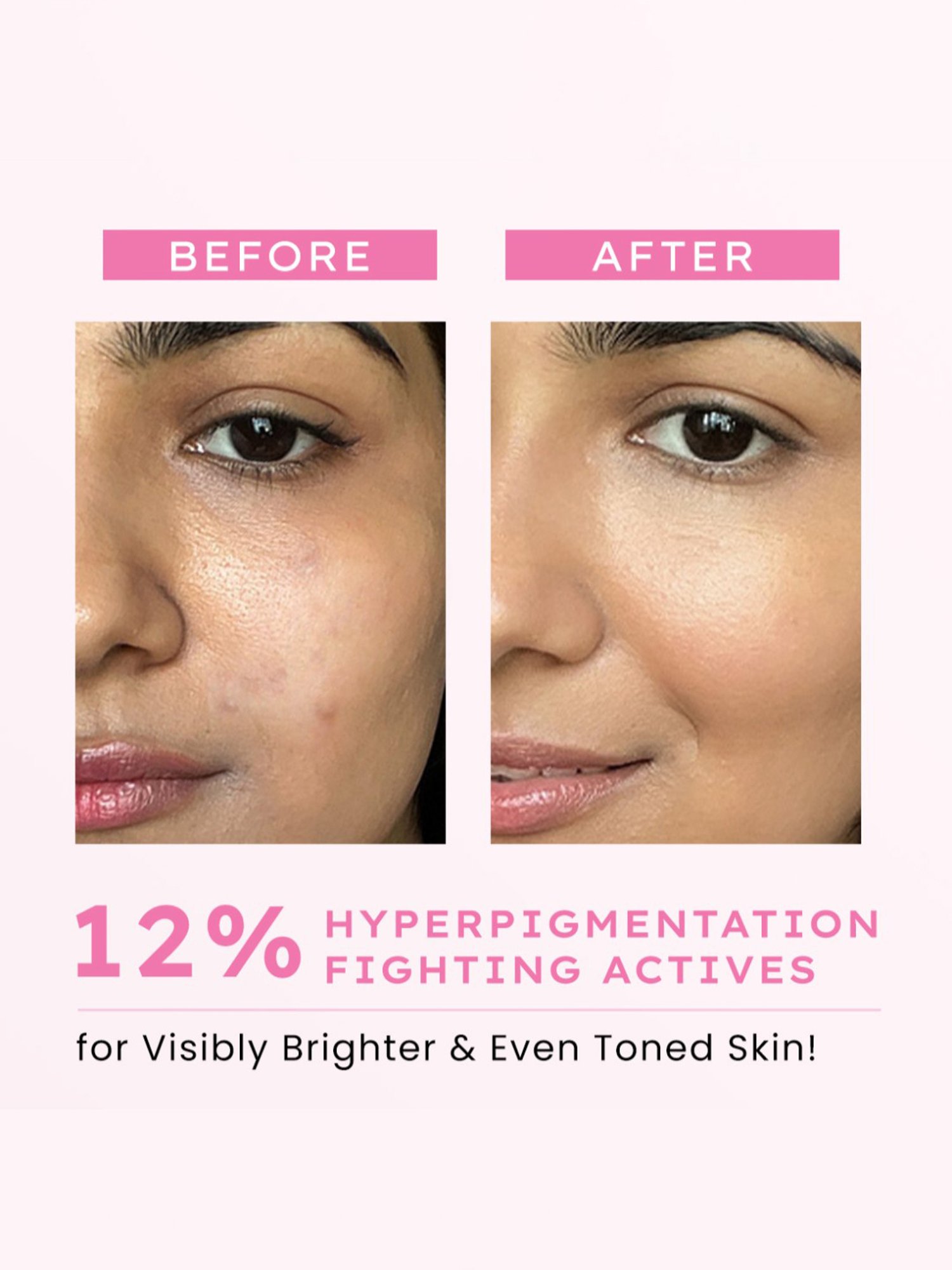 Hyphen Advanced De-Pigmentation Serum - 30 ml
