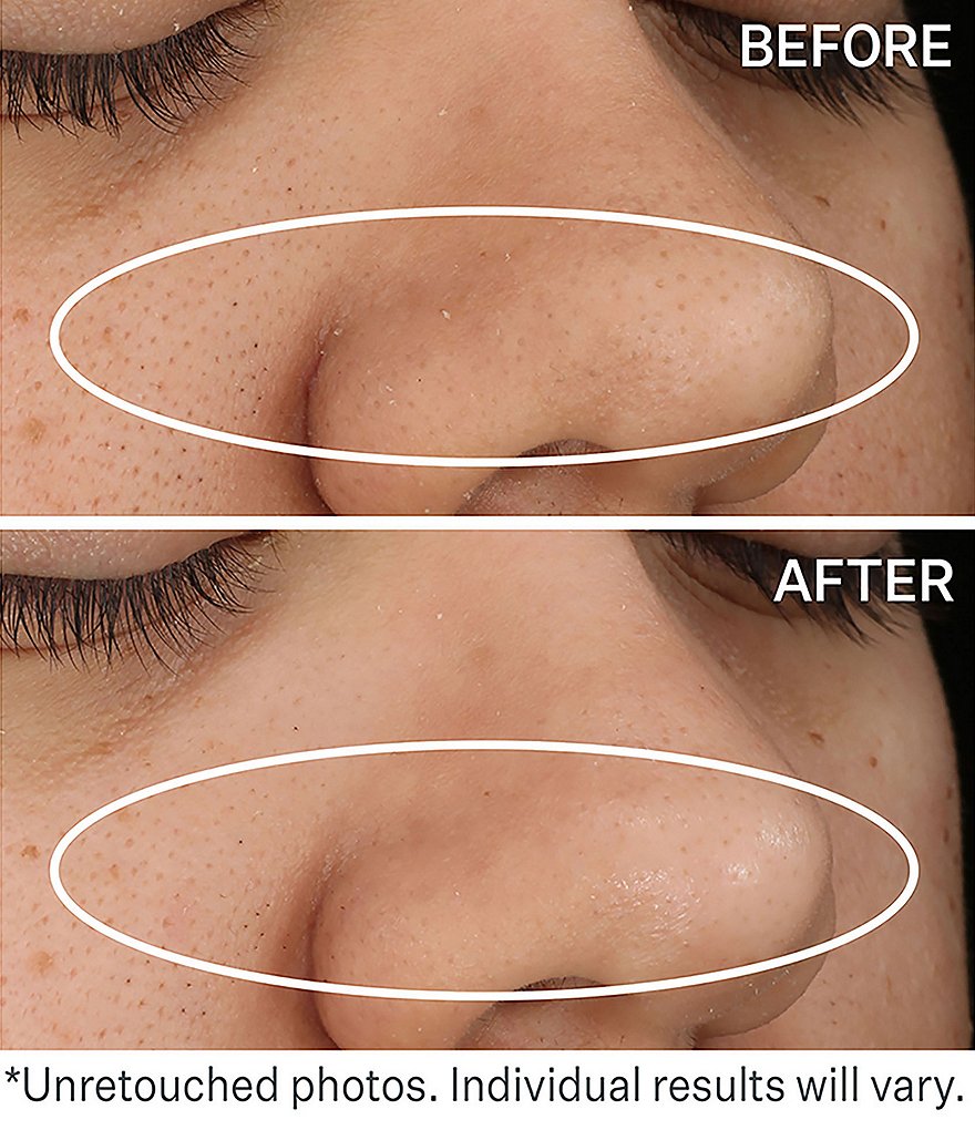 StriVectin DAILY REVEAL&trade; Exfoliating Pads