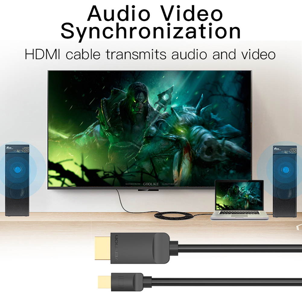 Vention Mini Displayport(Thunderbolt Compatible) to HDMI Cable,Gold Plated Connector 1080P for MacBook Air/Pro, Surface Pro/Dock, Monitor, Projector, and More