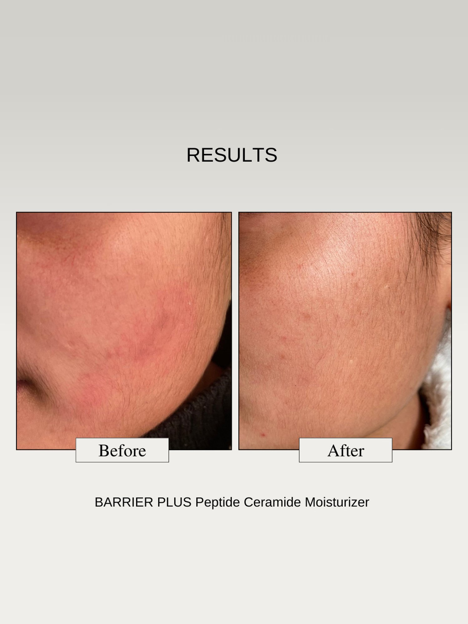 The Formularx Barrier Plus Peptide Ceramide Moisturizer - 50 gm