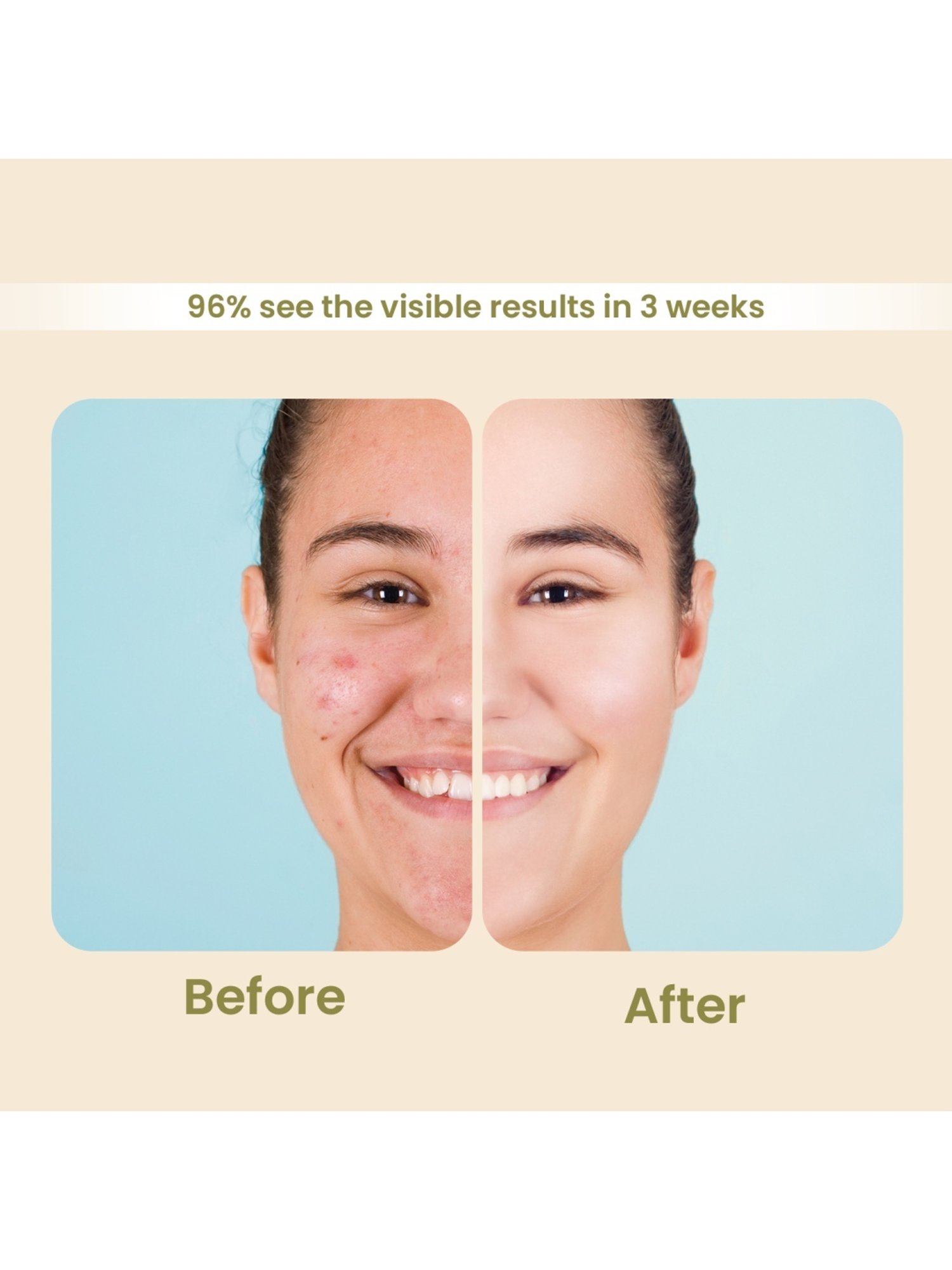 Earthraga Extra Protection Salicylic Acid Sunscreen SPF 50 Matte - 100 ml