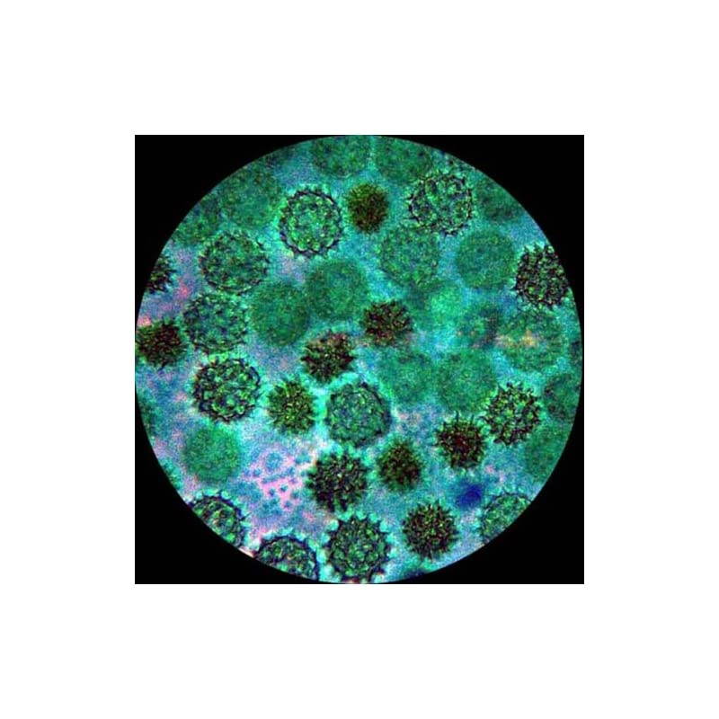 K104YY Elementary StereoDissecting Microscope 10x and 16x Widefield Eyepiece 20x32x Magnification Reversible BlackWhite Stage Plate HeavyDuty Frame