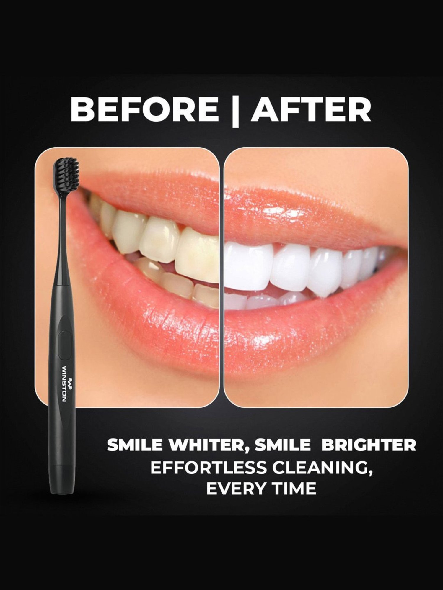 Winston Sonic Electric Toothbrush with Charcoal Bristles AAA Battery Operated (Black)