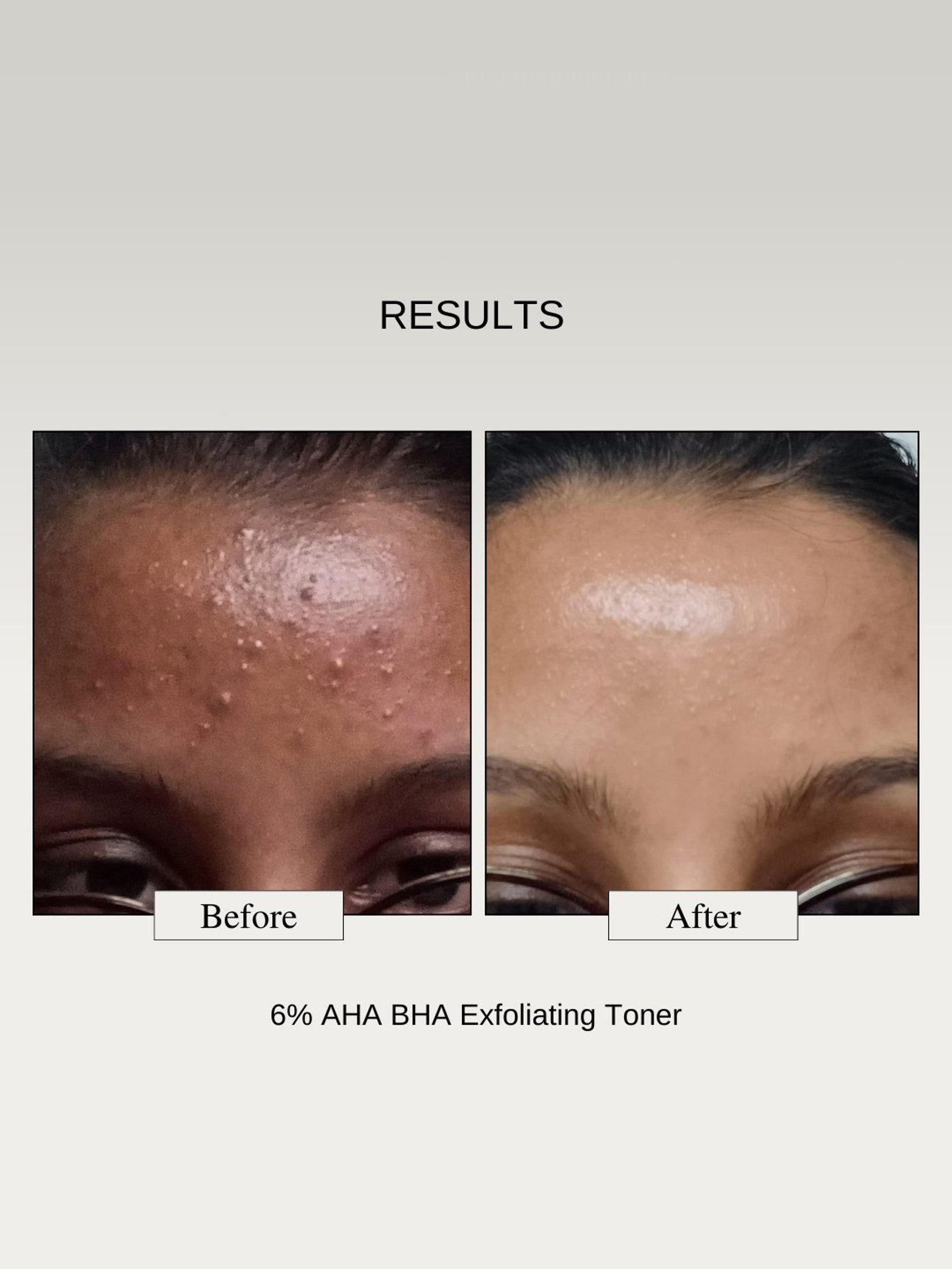 Paula's Choice Skin Perfecting 8% AHA Gel Exfoliant Travel Size 15 ml