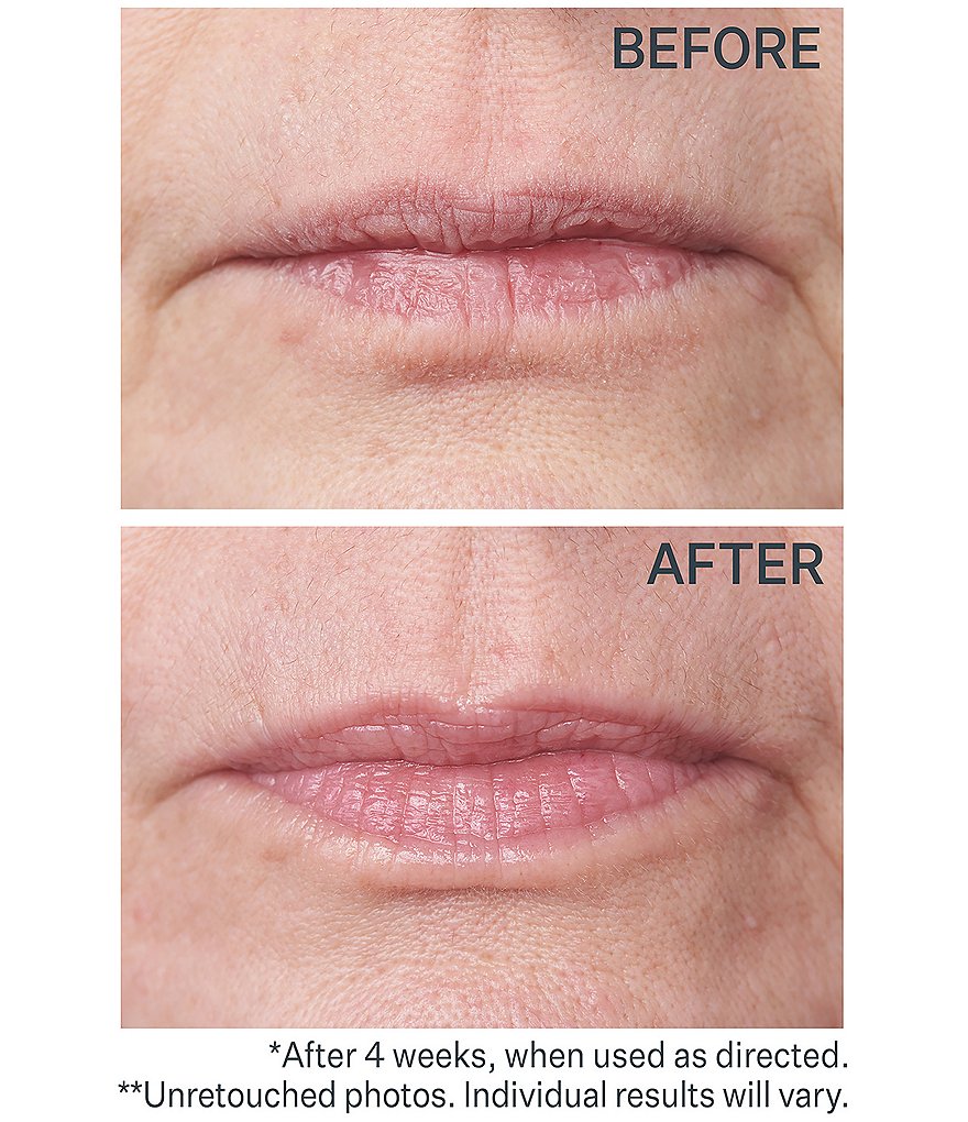 StriVectin Double Fix&trade; for Lips Plumping & Vertical Line Treatment