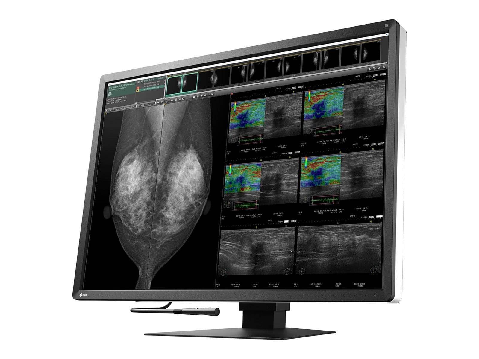 Eizo Radiforce RX1270 12MP 31'' Color Medical Display Mammography Monitor (RX1270)