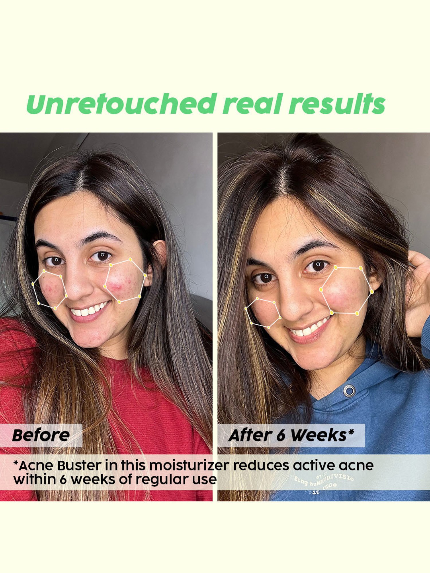 PLIX THE PLANT FIX Jamun Active Acne Smoothie Moisturizer - 30 gm