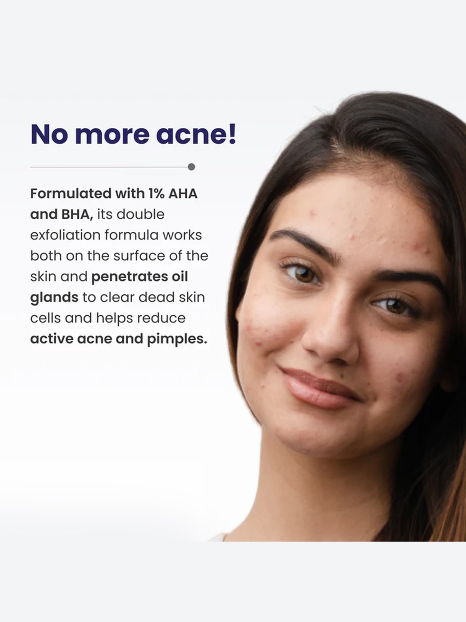 Re'equil AHA BHA Acne Clarifying Gel - 20 gm