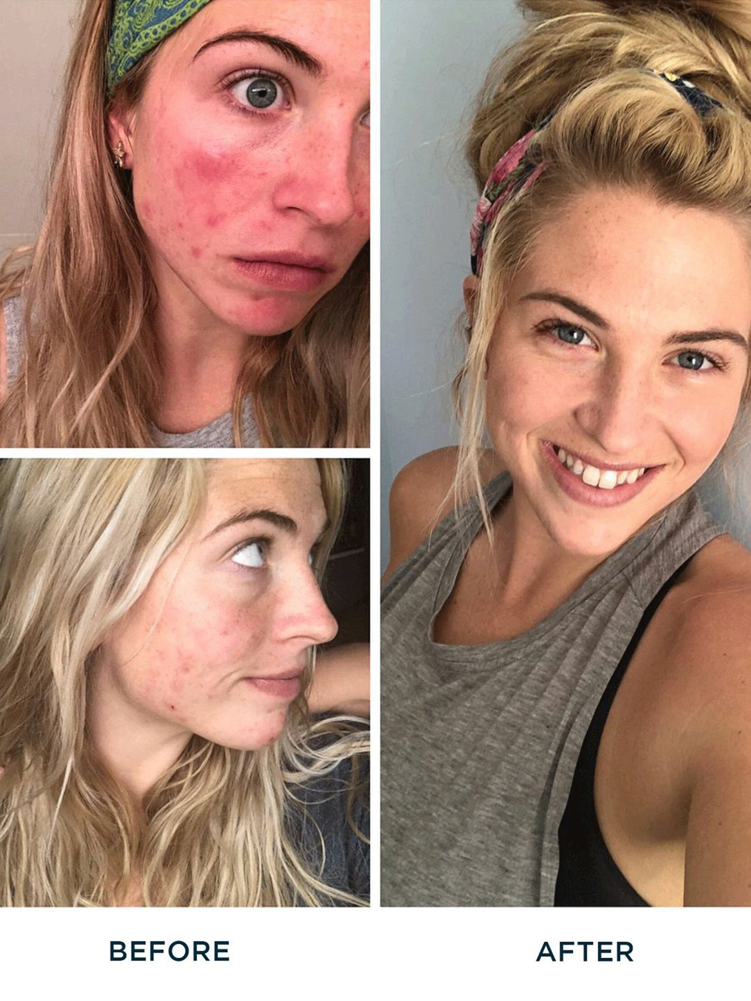 FRE Detox Me Instant Clearing Mask - 50 ml