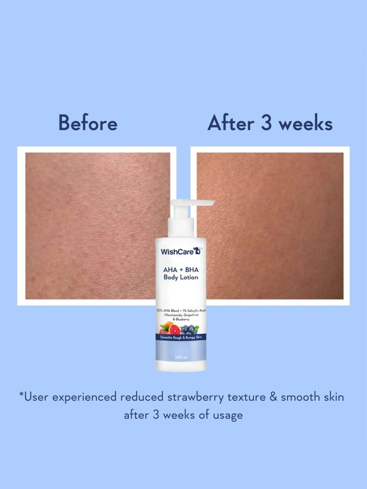 Wishcare Grapefruit & Blueberry AHA + BHA Body Lotion - 200 ml