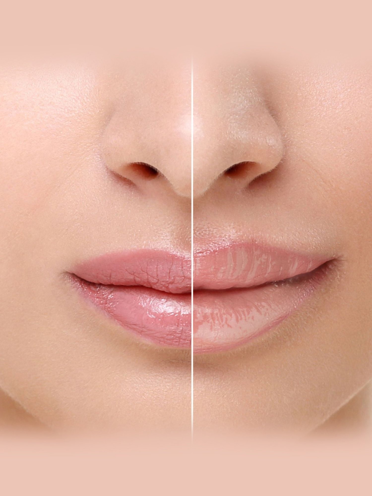 RENEE Tease Lip Plumper & PH Madness Stick Combo