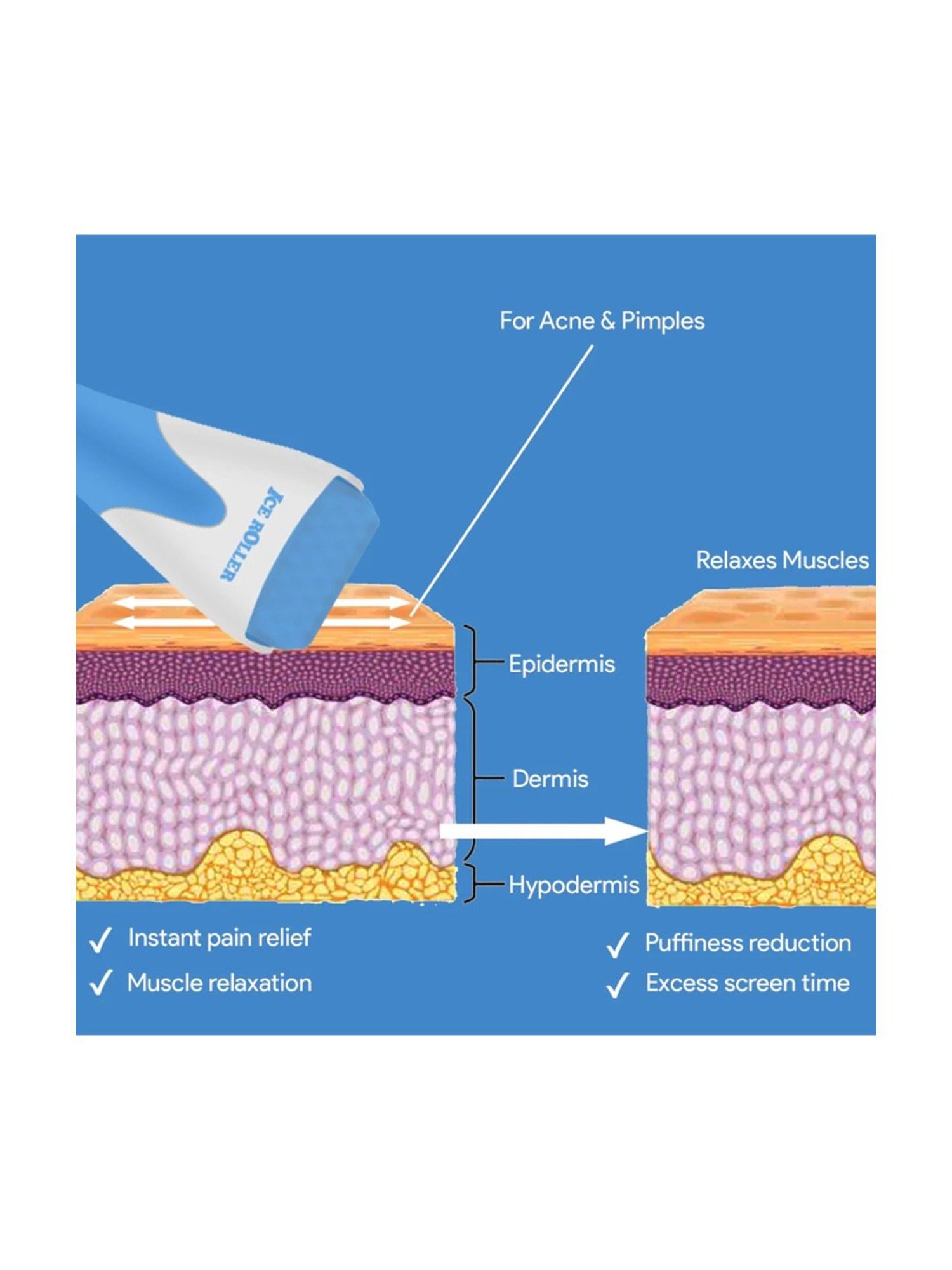 House of Beauty Blue Ice Roller - 187 gm