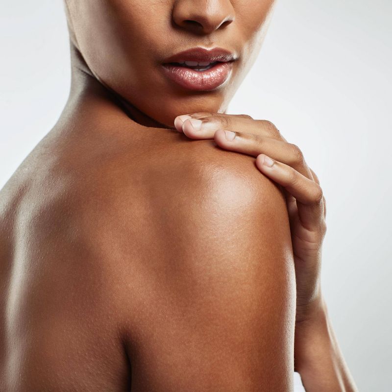 Olay KP Bump Body Scrub with Glycolic Acid and Vitamin B3 Complex - 4.5 fl.oz 