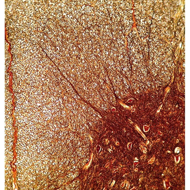 Microscope/Telescope Adapter for iPhone X