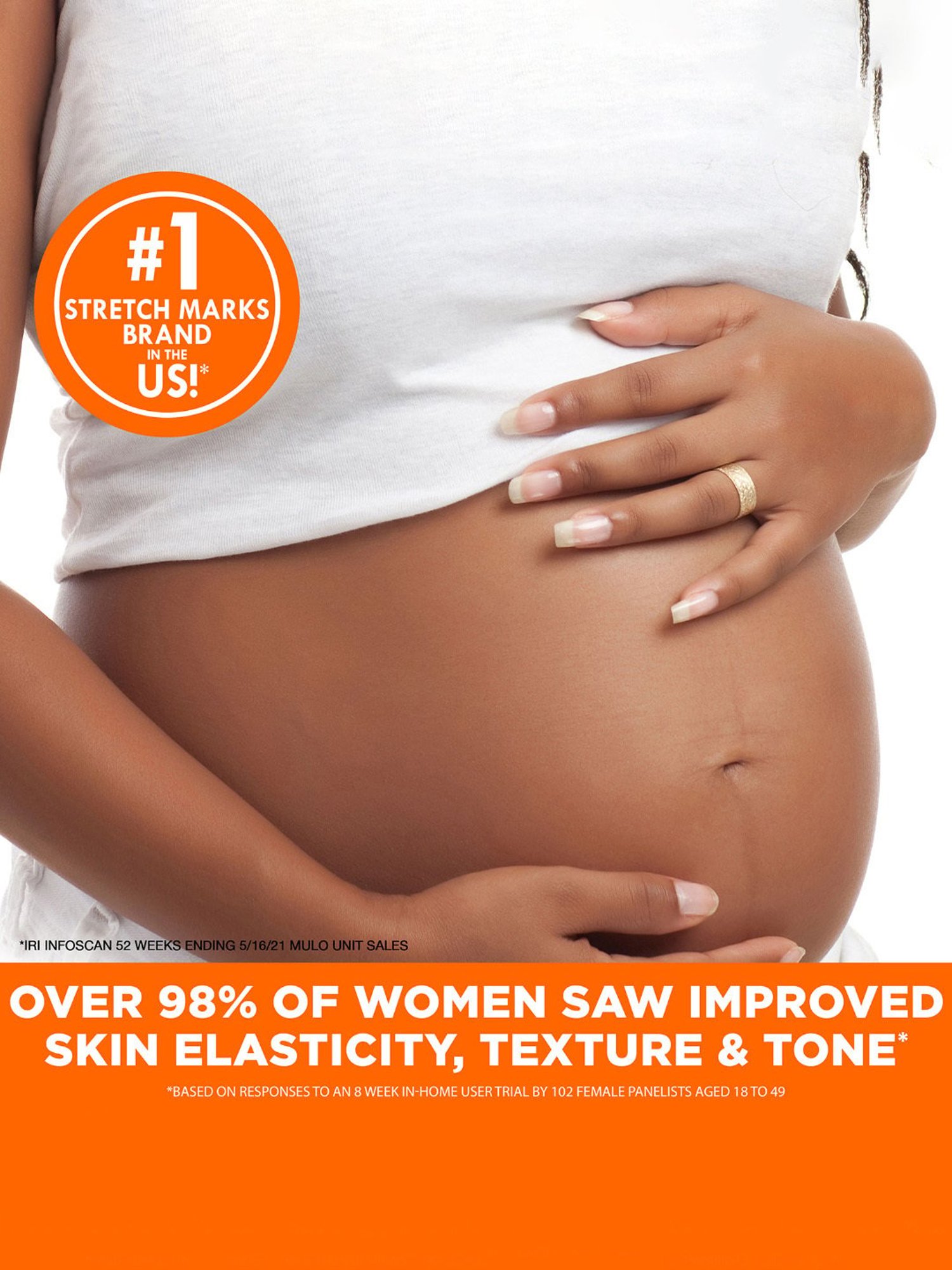 Palmer's Cocoa Butter Formula with Vitamin E Massage Lotion for Stretch Marks - 250 ml