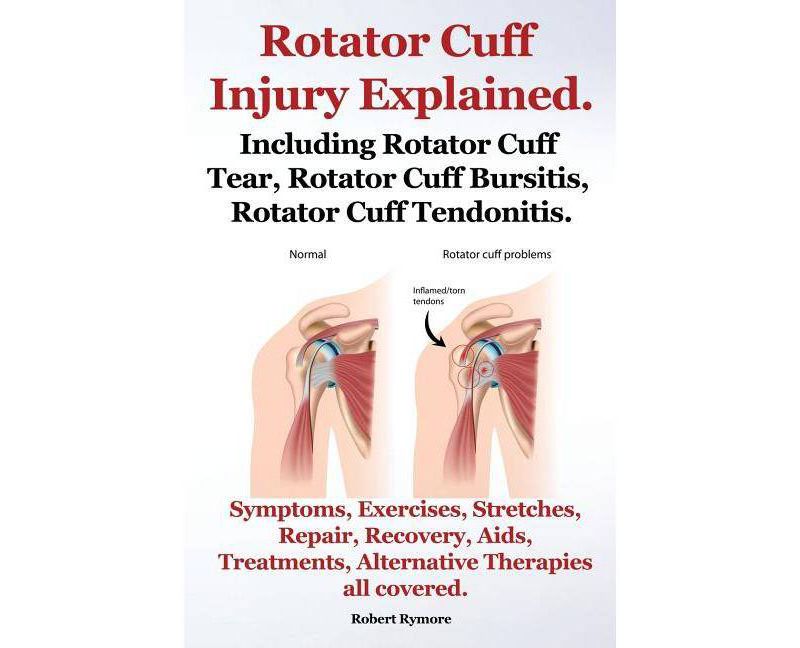 Rotator Cuff Injury Explained. Including Rotator Cuff Tear, Rotator Cuff Bursitis, Rotator Cuff Tendonitis. Symptoms, Exercises, Stretches, Repair,