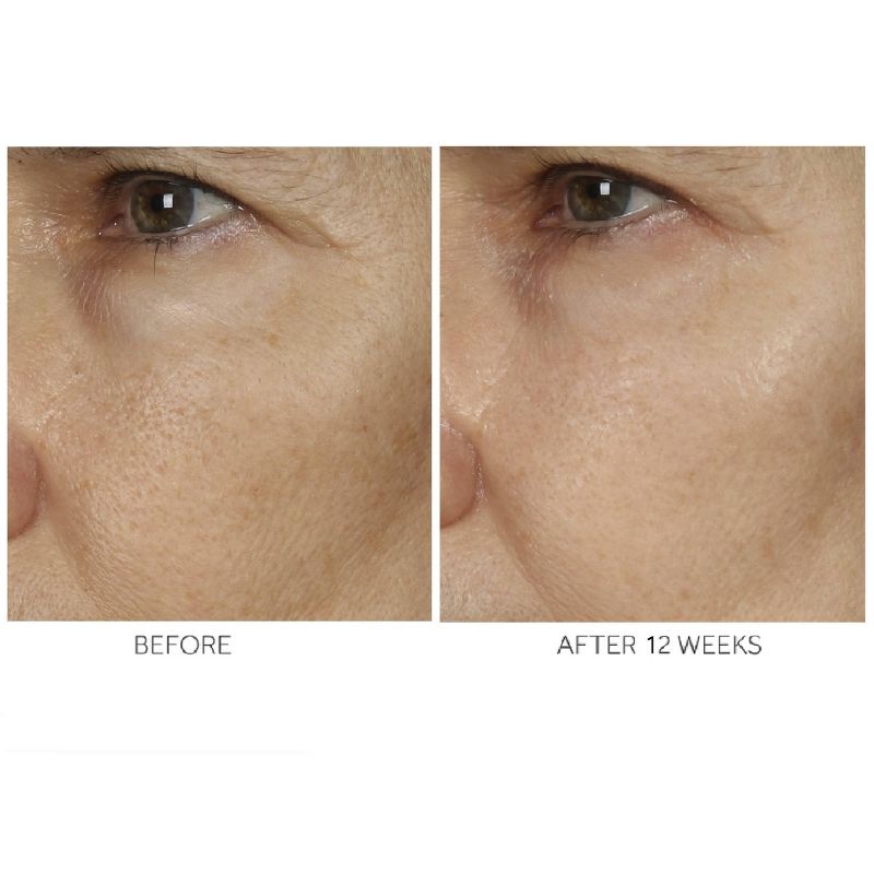 No7 Advanced Retinol 1.5% Complex Night Concentrate - 1 fl oz