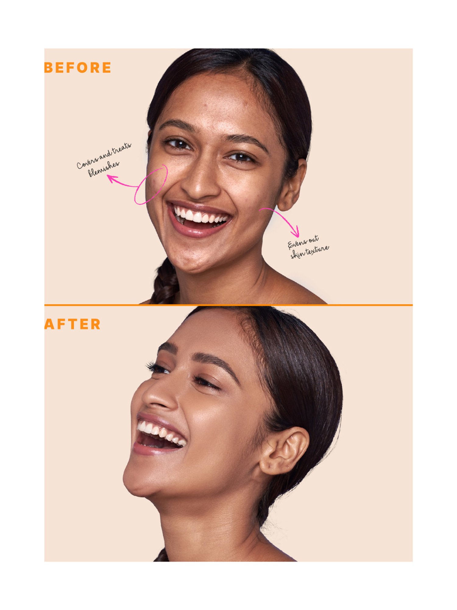 TYPE BEAUTY Zit Quit Concealer Biscotti - 8 ml