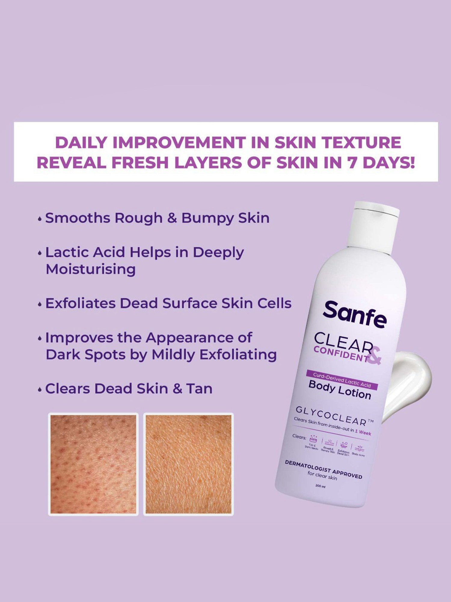 Sanfe Clear & Confident Curd-Derived Lactic Acid Body Lotion - 200 ml