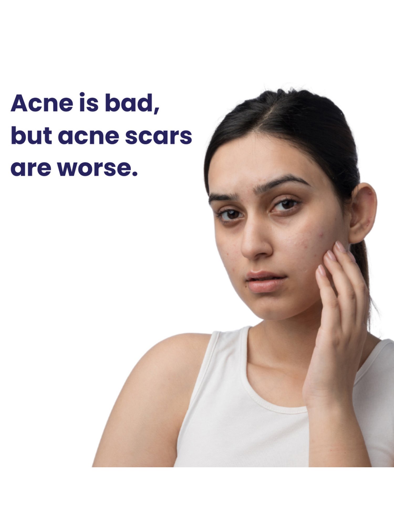 Re'equil Pitstop Blue Niacinamide Serum for Acne & Scar - 25 ml