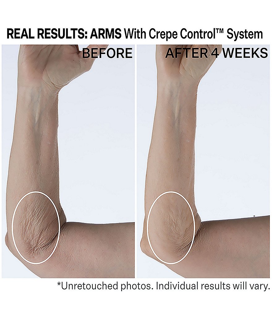 StriVectin Crepe Control&trade; Tightening Body Cream