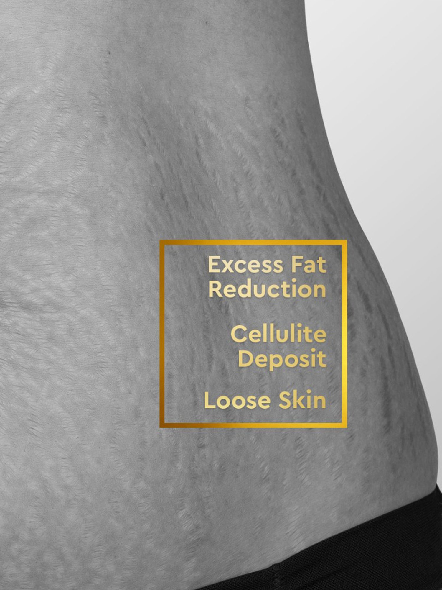 VLCC Clinic ProShape Slimming Oil & Anti Stretch Mark Cream Combo