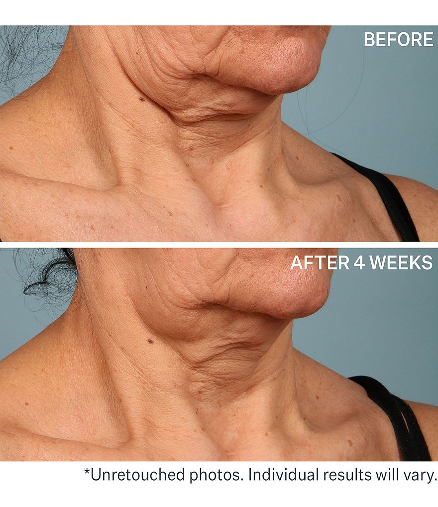 StriVectin TL ADVANCED&trade; Tightening Neck Cream Plus