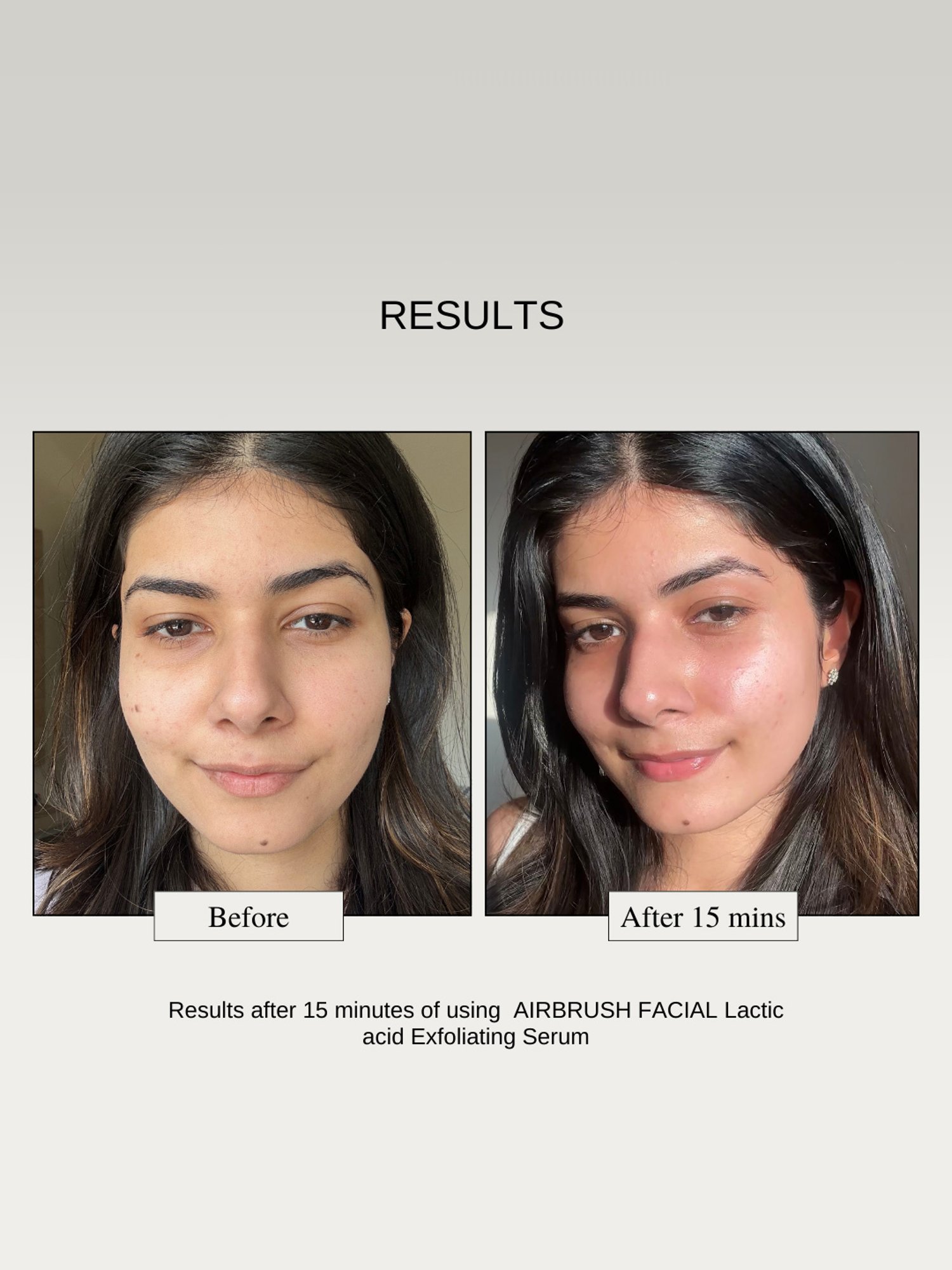 The Formularx Air Brush Facial Lactic Acid Serum - 50 gm