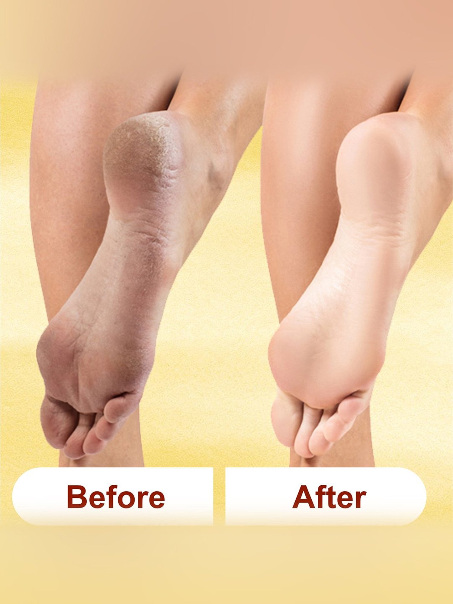 Kazarmaa Heal & Repair Lemon Foot Cream - 100 gm